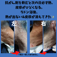 画像1409